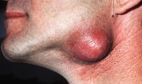 葛根加盟,戒檳榔項(xiàng)目,葛根品牌